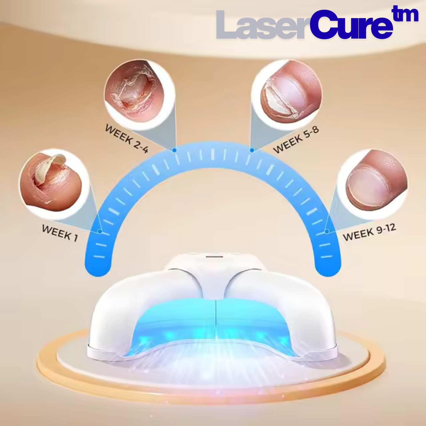 LaserCure™ -  Tratamiento láser para hongos en uñas