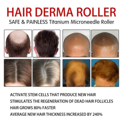 Luminé™ - RODILLO DERMA FACIAL