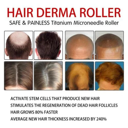 Luminé™ - RODILLO DERMA FACIAL
