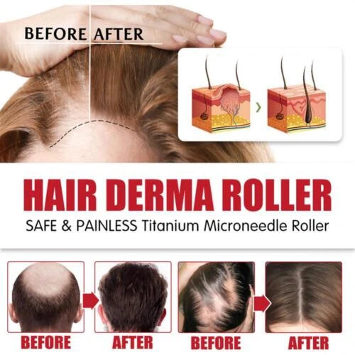 Luminé™ - RODILLO DERMA FACIAL